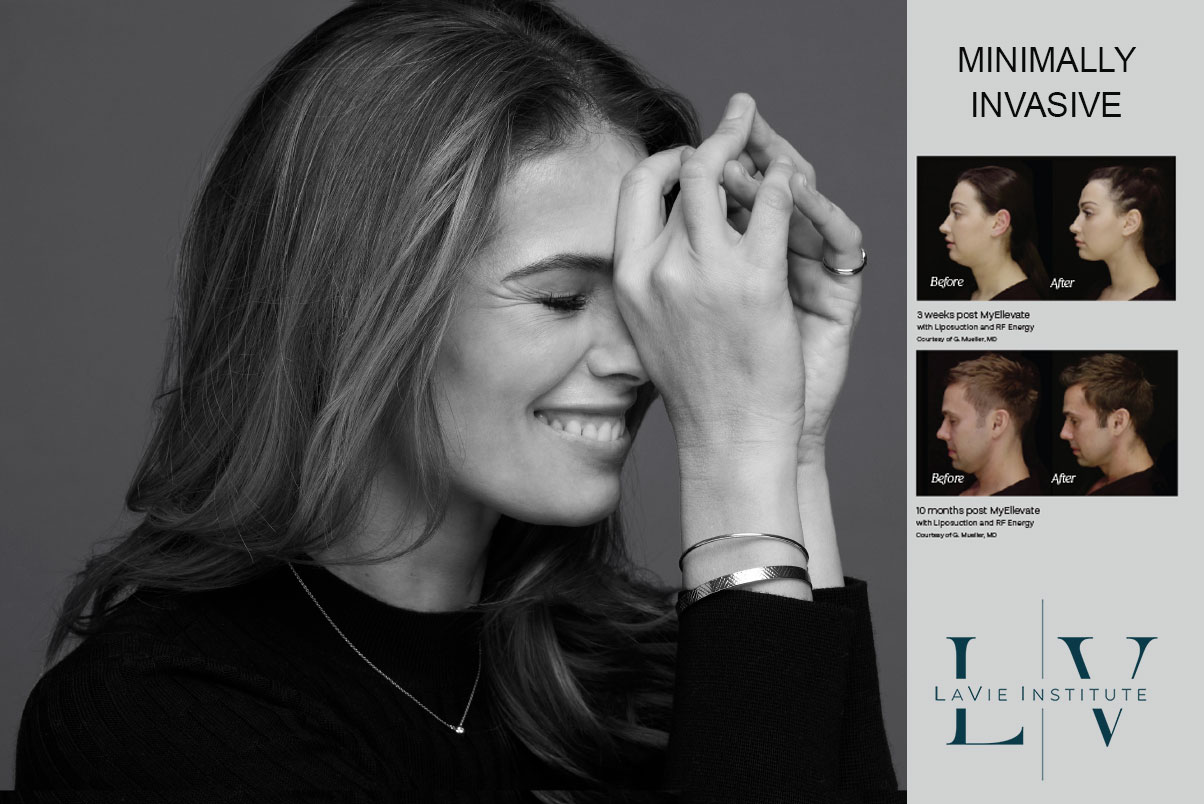 woman smiling with before after images